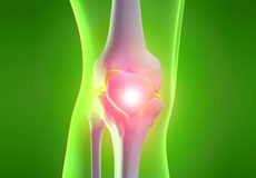 Knee Pain